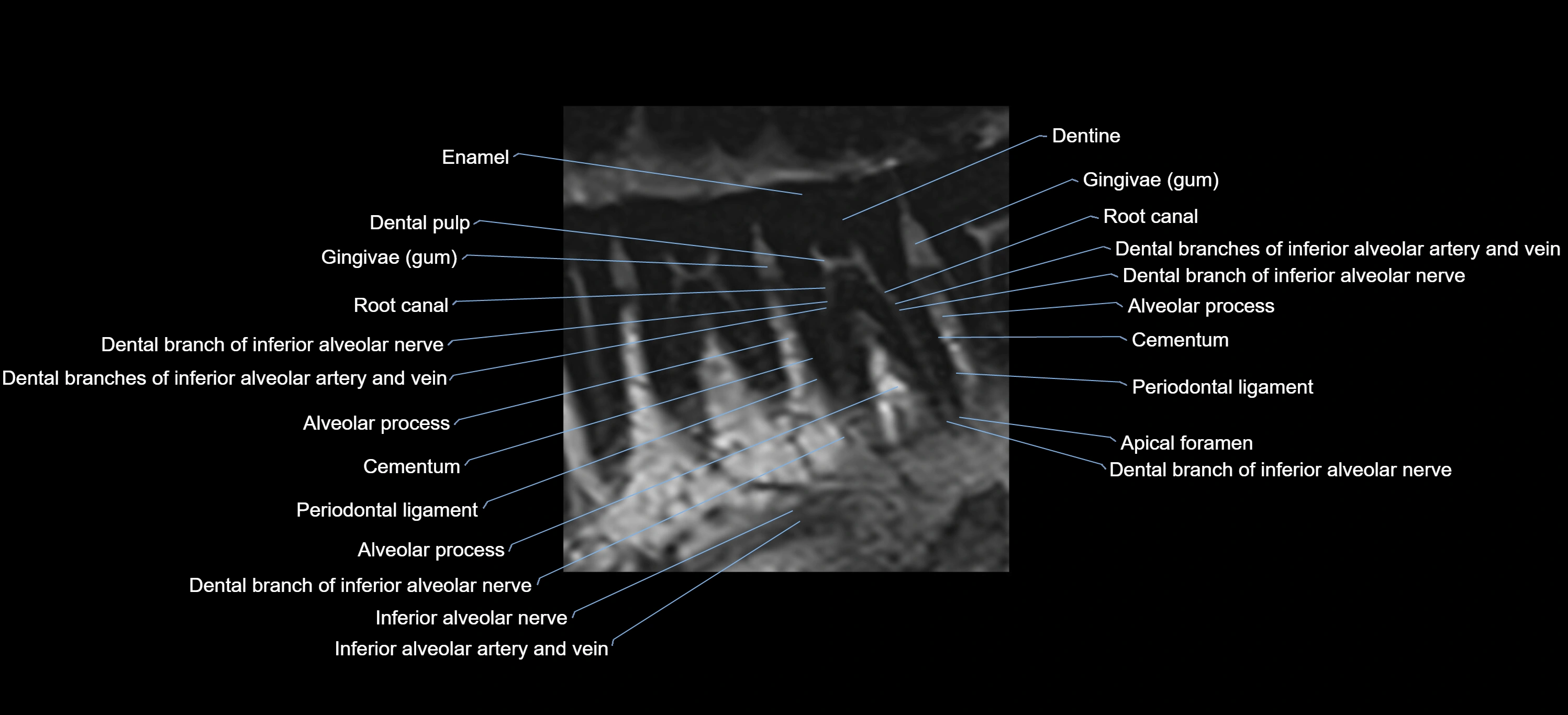 mri tooth sagittal micro cross sectional 3T anatomy -img-00004.webp
